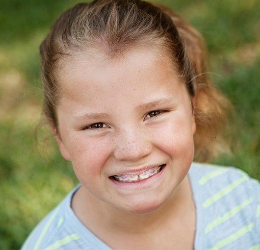 Little girl with phase 1 braces